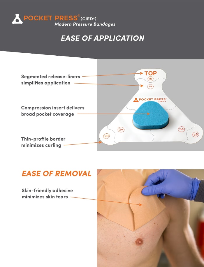 A Unique Pressure Bandage Approach for the Prevention of Device Pocket  Hematoma